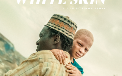 The Boy With White Skin